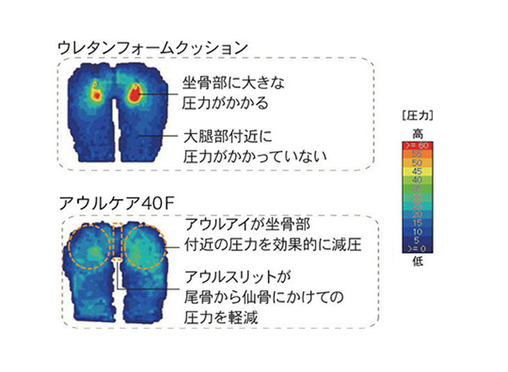 長時間の車椅子生活で起こる前ずれやお尻の痛みを解決